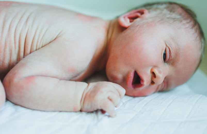 Ce qu’il ne faut pas faire en cas de boutons de chaleur chez le bébé-L'enfant dans la nature Ce qu’il ne faut pas faire en cas de boutons de chaleur chez le bébé-L'enfant dans la nature