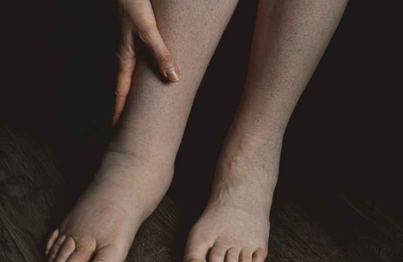 Comment faire dégonfler les pieds rapidement et naturellement ?-L'enfant dans la nature